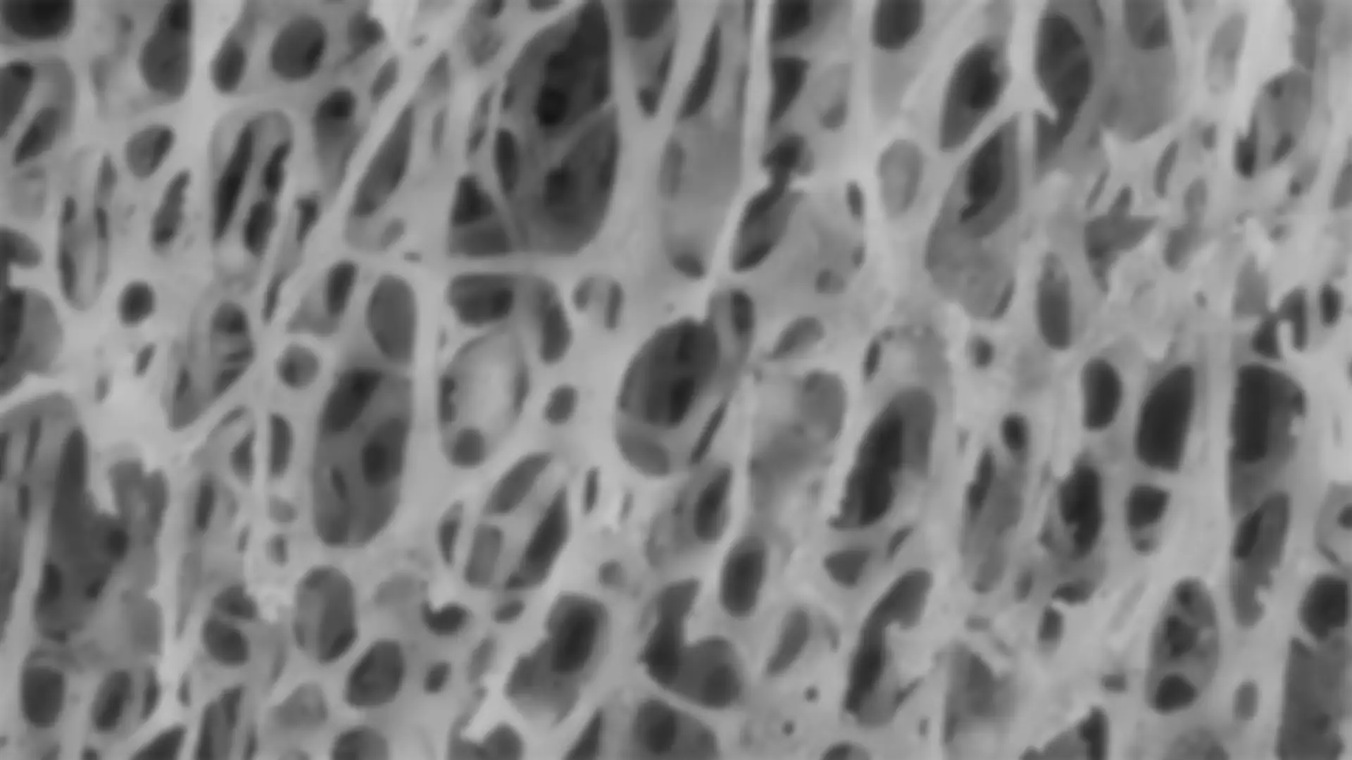 bone background photo